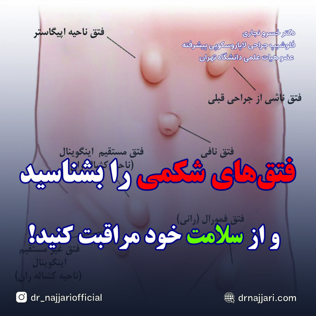 جراحی فتق چیست؟