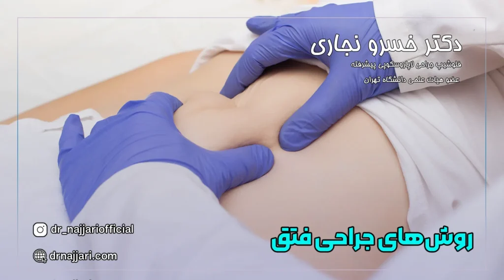 روش‌های جراحی فتق