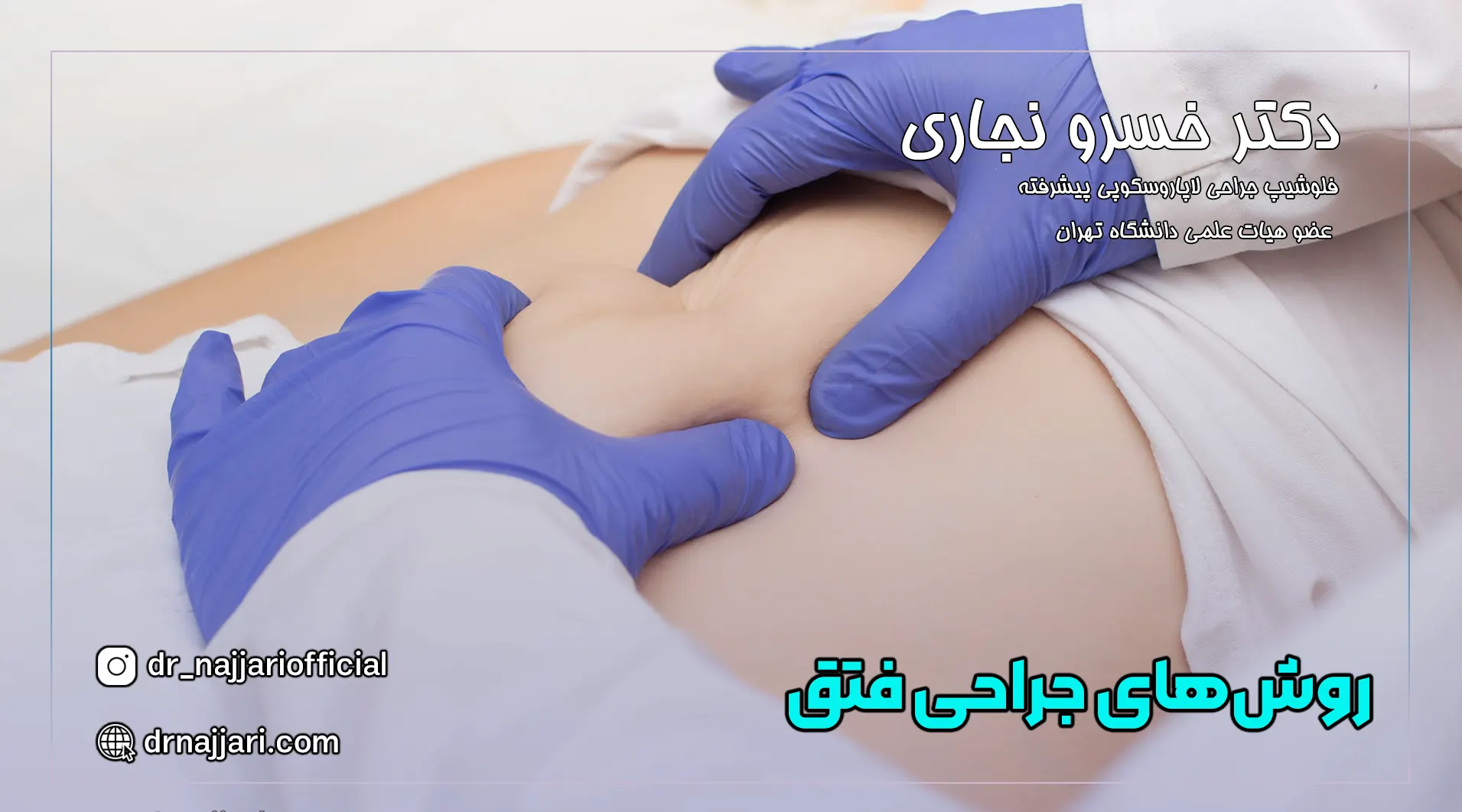 روش‌های جراحی فتق