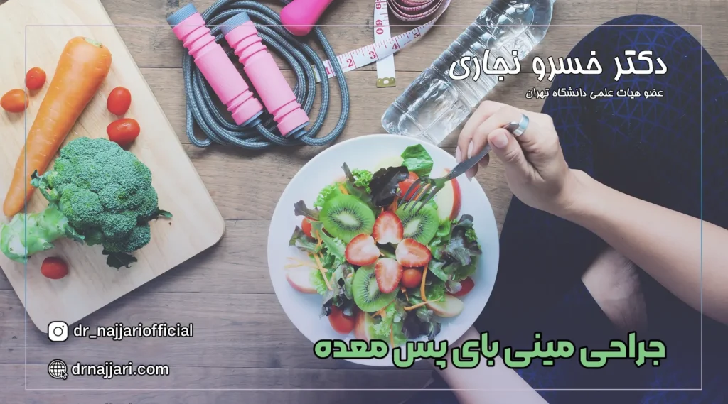 رژیم غذایی و ورزش پس از جراحی مینی بای پس معده