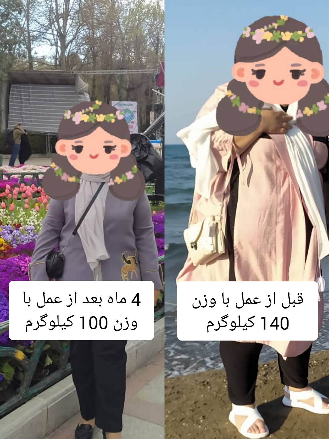 خانم - قبل از عمل با وزن 140 کیلوگرم - چهار ماه بعد از عمل با وزن 100 کیلوگرم