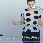 زندگی بعد از جراحی اسلیو معده