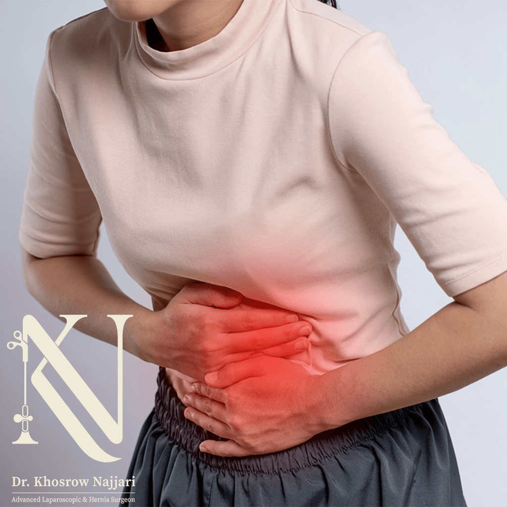 علائم فتق در زنان