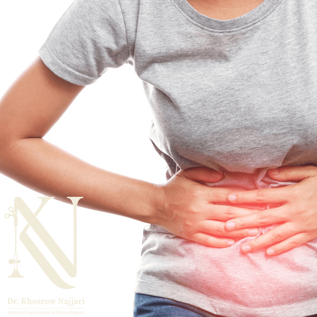 اندازه فتق برای عمل