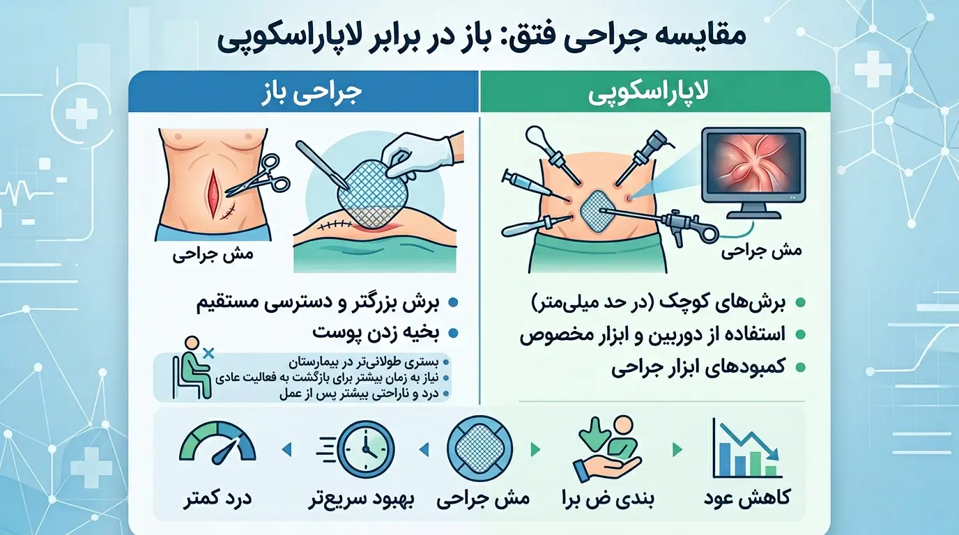 اینفوگرافیک مقایسه جراحی باز و لاپاراسکوپی فتق و مزایای هر روش