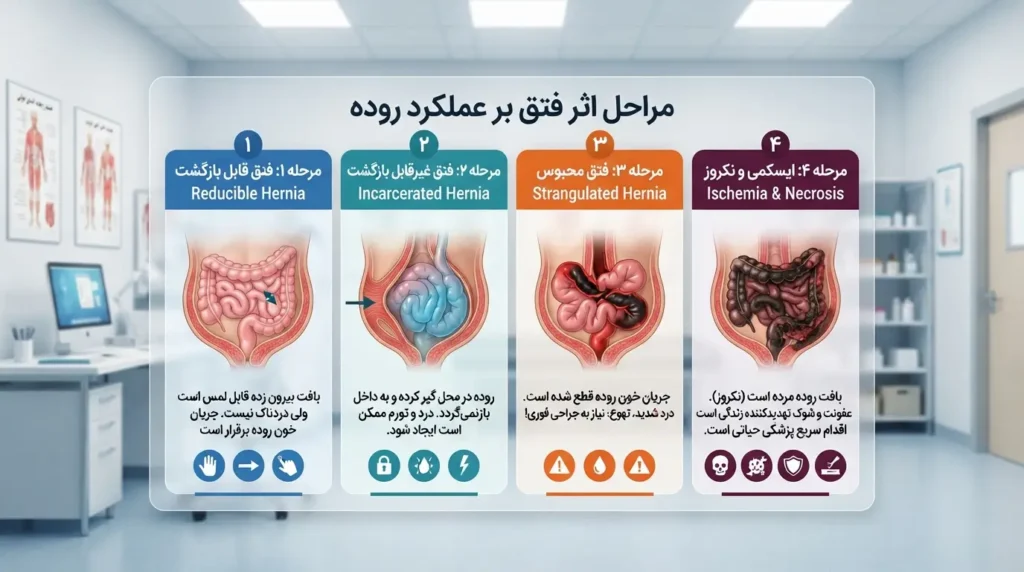 فتق و یبوست - چگونه فتق بر عملکرد روده تأثیر میگذارد